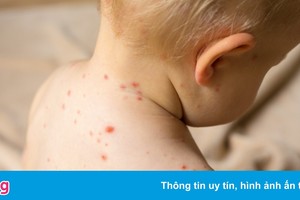 4 bệnh thường gặp ở trẻ vào dịp đầu năm mới