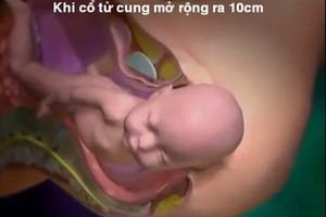 Cận cảnh khoảnh khắc em bé chui ra khỏi cơ thể người mẹ 