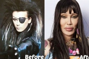 Pete Burns thay đổi thế nào sau 300 lần phẫu thuật thẩm mỹ?