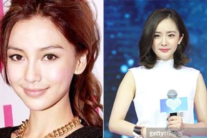 Angelababy, Dương Mịch phát tài nhờ phẫu thuật thẩm mỹ