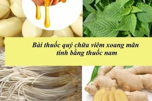 Trời càng lạnh xoang càng đau nhức: Dùng gừng theo cách này là khỏi