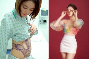 Hotgirl Trâm Anh khoe eo thon sau khi hút mỡ bụng 3 tháng