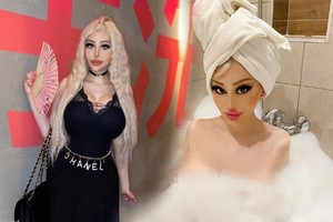 Cô gái giống búp bê Barbie sau 10 cuộc phẫu thuật từ 17 tuổi