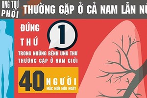 Bệnh Minh Thuận mắc khiến 17.000 người Việt chết mỗi năm