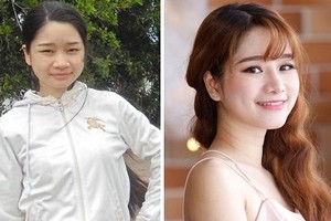 Cô gái Nha Trang quyết tâm "dao kéo" để hâm nóng tình yêu