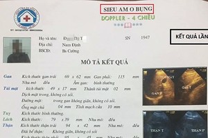 BVĐK 16A Hà Đông: Một bệnh nhân, hai bác sĩ khám ra kết quả khác nhau