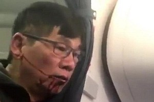 United Airlines bồi thường "khủng" cho bác sĩ Dao 