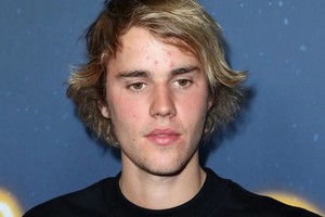 Giữa ồn ào với Taylor SwiftJustin,  Bieber xuất hiện mặt đầy mụn 