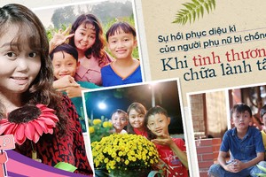 Sự hồi phục diệu kì của người phụ nữ bị chồng châm lửa đốt