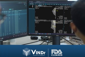 Đạt chuẩn FDA khắt khe, sản phẩm AI của VinBigdata rộng cửa kinh doanh trên toàn cầu