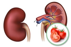 Nếu gặp 6 dấu hiệu này sau khi ăn cà chua thì bạn nên dừng lại