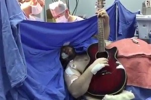 Người đàn ông vừa phẫu thuật não vừa đánh đàn guitar