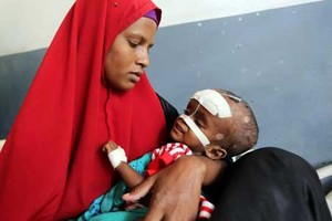 Những hình ảnh nhói lòng về nạn đói ở Somalia