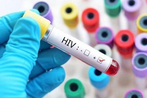 Điểm danh những yếu tố khiến việc điều trị HIV thất bại