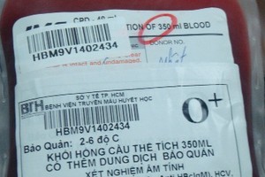 Kỹ thuật mới: phát hiện HIV trong 11 ngày 