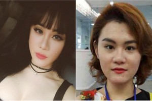 Khuôn mặt trước phẫu thuật gây sốc của DJ Bến Tre