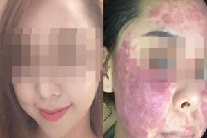 Tham mua mỹ phẩm “rởm”, chị em lên mạng kêu khóc