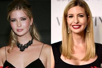 Lộ bằng chứng nghi phẫu thuật thẩm mỹ của Ivanka Trump