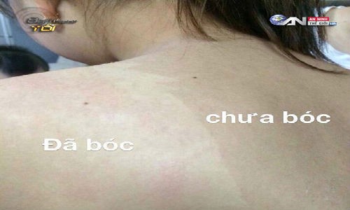 Mê trận lột da tắm trắng siêu tốc giá bèo hút teen Việt