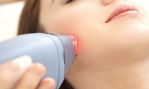 Triệt lông bằng laser tăng nguy cơ ung thư?