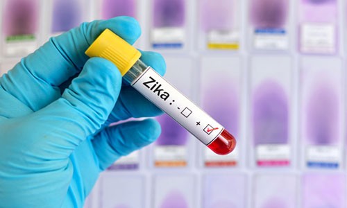 Bí ẩn đe dọa virus Zika lây nhiễm từ người sang người