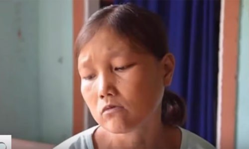 Video: Cô gái nặng 25kg ăn 5 lon gạo, uống 10 lít nước mỗi bữa 