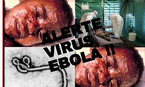 Tiết lộ bất ngờ về tên gọi virus Ebola 