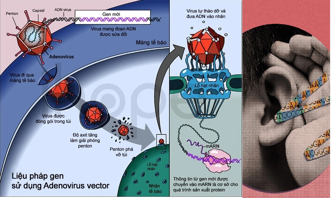 Cho đến nay, liệu pháp gen là giải pháp duy nhất để chữa trị câm điếc bẩm sinh.