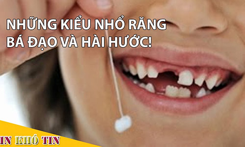 Video: Muôn kiểu nhổ răng bá đạo cho trẻ nhỏ