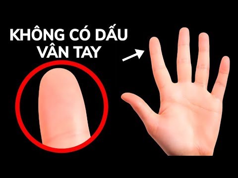 Video: Chuyện gì sẽ xảy ra nếu bạn mất dấu vân tay?