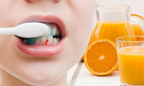 Bổ sung ngay vitamin C nếu cơ thể bạn có những triệu chứng này