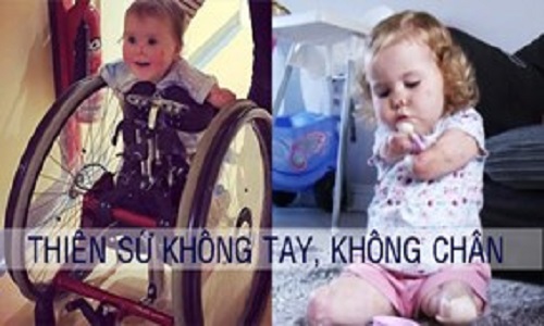 Thiên sứ “không chân tay” khiến cả thế giới không thể không yêu