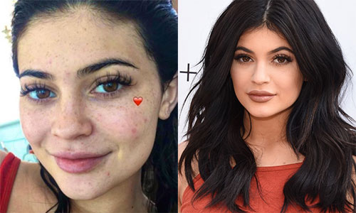 Mẫu trẻ Kylie Jenner lộ ảnh mặt mộc đầy tàn nhang