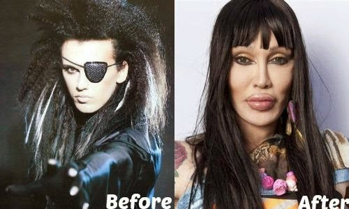 Pete Burns thay đổi thế nào sau 300 lần phẫu thuật thẩm mỹ?