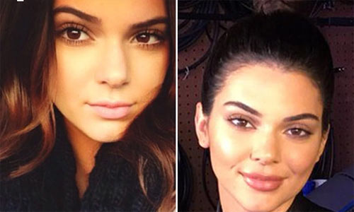 Bị nghi phẫu thuật thẩm mỹ, Kendall Jenner phản ứng thế nào?