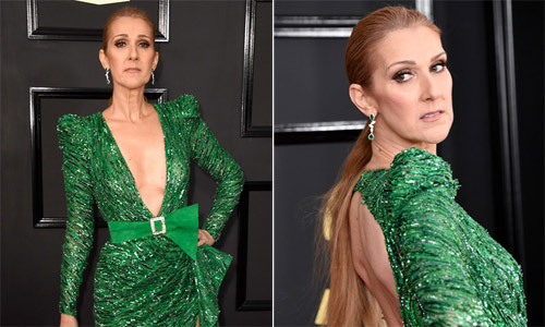 Celine Dion không giấu được vẻ già nua ở tuổi U50