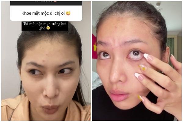 Ngọc Thảo lộ môi thâm, da đầy mụn sau lớp make up vi diệu