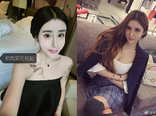 Nhan sắc bỗng nhiên xinh đẹp nhờ thẩm mỹ của “hot girl mặt rắn” Trung Quốc