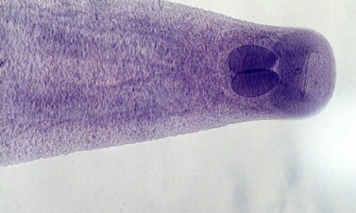 Ảnh “hiền khô” của ký sinh trùng đáng sợ trong thức ăn