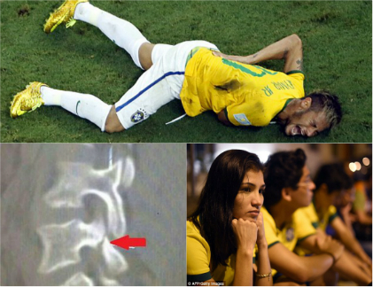 Fan Brazil bàng hoàng vì chấn thương cột sống của Neymar