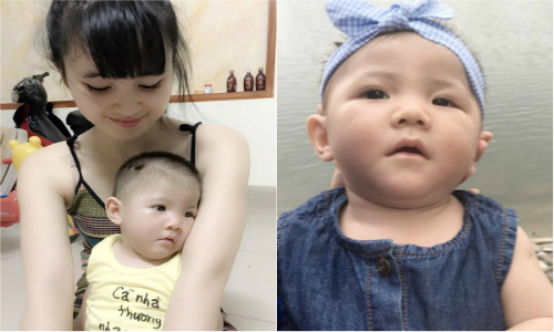 Cảm phục “tiên nữ” Lào Cai khéo chăm bé 14 tháng nặng 3,5kg