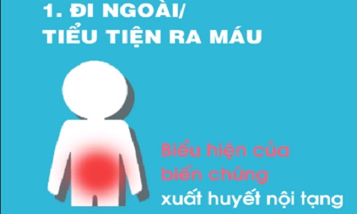 Dấu hiệu khi mắc sốt xuất huyết cần nhập viện ngay 