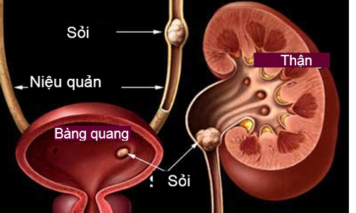 Tiết lộ lý do khiến bạn tiểu tiện nhiều lần trong ngày