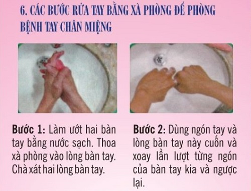 Hướng dẫn phòng bệnh tay chân miệng bằng hình ảnh