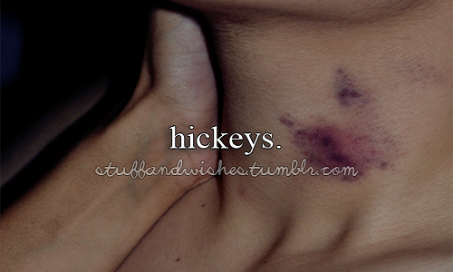 Hickey Kiss, trào lưu hôn rợn người của các cặp đôi