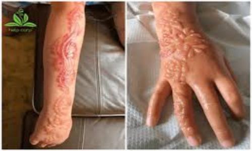 Mê mẩn trào lưu xăm henna, giới trẻ phải chịu hệ lụy