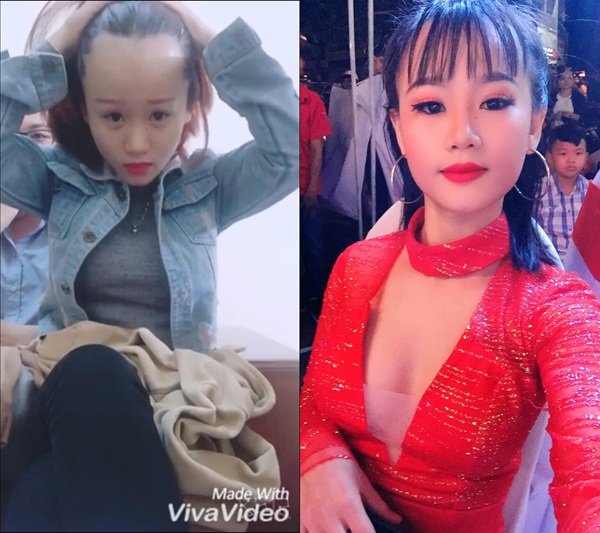 1001 nỗi khổ bất tận của girl xinh sở hữu vầng trán sân bay "lồng lộng"