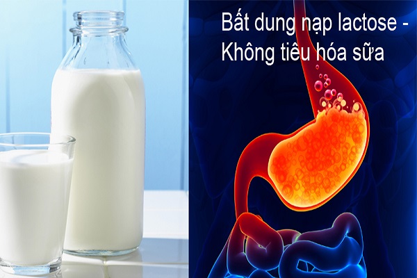 Video: Tại sao nhiều người bị đau bụng khi uống sữa? 