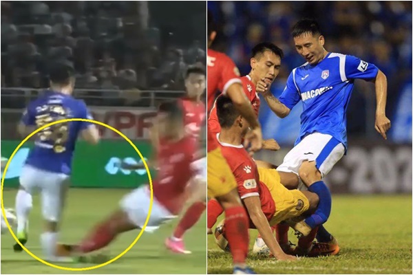 Trước Đỗ Hùng Dũng, V-League từng chứng kiến bao vụ gẫy chân?