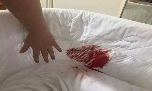 Mẹ kinh hoàng phát hiện nôi con trai nhuốm đầy máu và sự thật rùng mình Mẹ kinh hoàng phát hiện nôi con trai nhuốm đầy máu và sự thật rùng mình